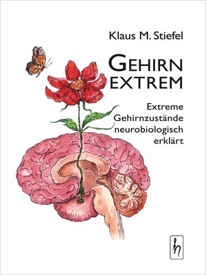 cover image of Gehirn extrem